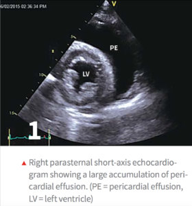 www_cliniciansbrief_com_sites_default_files_attachments_COC_Canine_20Pericardial_20Effusion_pdf_png copy